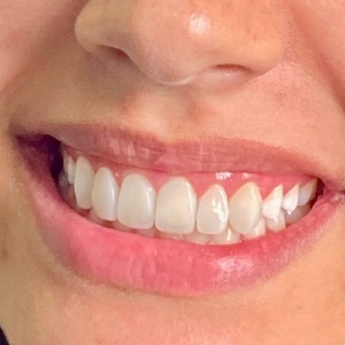 Dra tamia asmar Dentista em São João Del Rei, Minas Gerais (15)