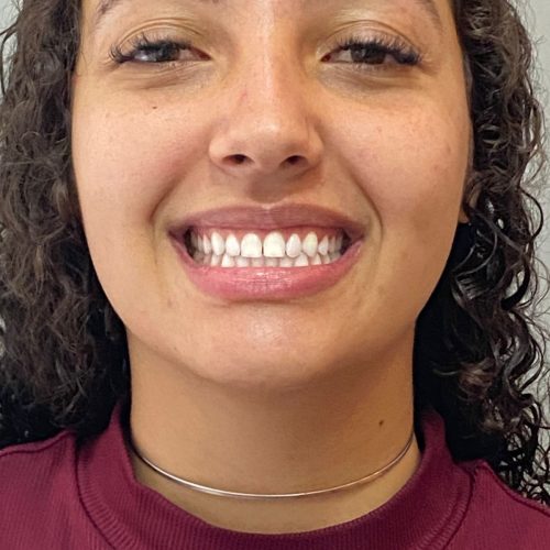 Dra tamia asmar Dentista em São João Del Rei, Minas Gerais (17)